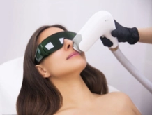 Laser Hair Removal Services