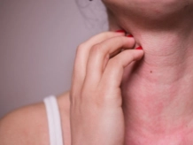 Relief from Skin Allergies with Treatment